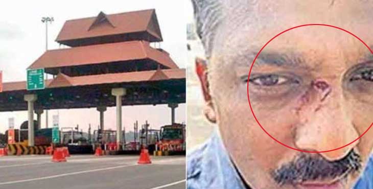 പാലിയേക്കര ടോള് പ്ലാസയില് സ്കൂട്ടര് യാത്രക്കാരായ ദമ്പതികള്ക്ക് നേരെ ജീവനക്കാരുടെ ക്രൂരമായ ആക്രമണം ; രണ്ടുപേര് ആശുപത്രിയില് പാലിയേക്കര ടോള് പ്ലാസയില് സ്കൂട്ടര് യാത്രക്കാരായ ദമ്പതികള്ക്ക് നേരെ ജീവനക്കാരുടെ ക്രൂരമായ ആക്രമണം ; രണ്ടുപേര് ആശുപത്രിയില്