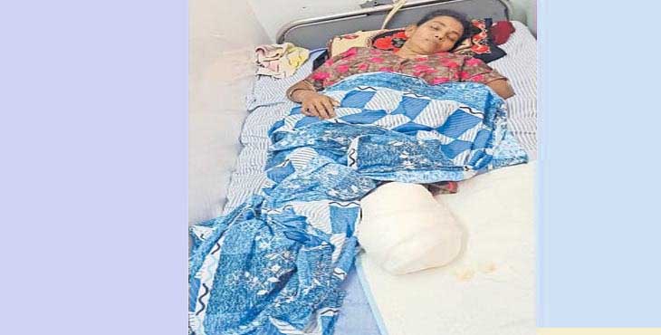 ഇറങ്ങുന്നതിനിടെ മുന്നോട്ടെടുത്ത കെഎസ്ആര്ടിസി ബസില് നിന്നു വീണ വീട്ടമ്മയുടെ കാല് മുറിച്ചു നീക്കി ഇറങ്ങുന്നതിനിടെ മുന്നോട്ടെടുത്ത കെഎസ്ആര്ടിസി ബസില് നിന്നു വീണ വീട്ടമ്മയുടെ കാല് മുറിച്ചു നീക്കി
