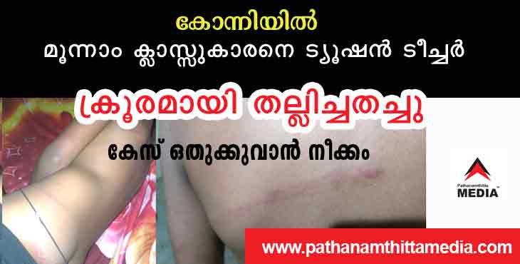 കോന്നി അട്ടച്ചാക്കലില് മൂന്നാം ക്ലാസ്സുകാരനെ ട്യൂഷന് ടീച്ചര് ക്രൂരമായി തല്ലിച്ചതച്ചു ; മണിക്കൂറുകളോളം കുട്ടി മയങ്ങിക്കിടന്നു ; കേസ് ഒതുക്കുവാന് നീക്കം കോന്നി അട്ടച്ചാക്കലില് മൂന്നാം ക്ലാസ്സുകാരനെ ട്യൂഷന് ടീച്ചര് ക്രൂരമായി തല്ലിച്ചതച്ചു ; മണിക്കൂറുകളോളം കുട്ടി മയങ്ങിക്കിടന്നു ; കേസ് ഒതുക്കുവാന് നീക്കം