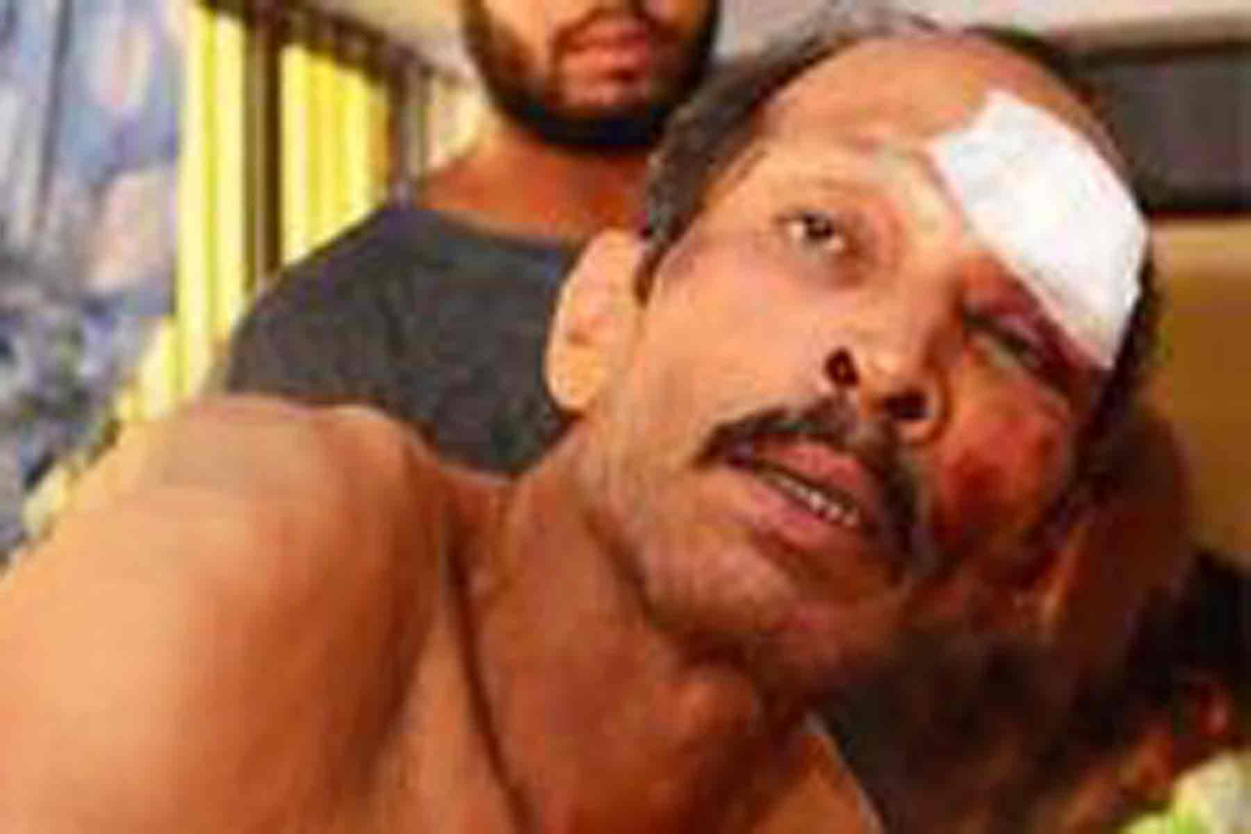 കൊലകൊമ്പന്റെ കാല്ചുവട്ടില് നിന്ന് പൗലോസിന് ഇത് രണ്ടാം ജന്മം കൊലകൊമ്പന്റെ കാല്ചുവട്ടില് നിന്ന് പൗലോസിന് ഇത് രണ്ടാം ജന്മം