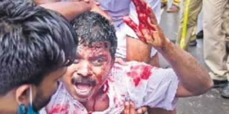 യൂത്ത് കോണ്ഗ്രസ് പത്തനംതിട്ട ജില്ലാ പ്രസിഡന്റ് എം ജി കണ്ണന് കോവിഡ് സ്ഥിരീകരിച്ചു യൂത്ത് കോണ്ഗ്രസ് പത്തനംതിട്ട ജില്ലാ പ്രസിഡന്റ് എം ജി കണ്ണന് കോവിഡ് സ്ഥിരീകരിച്ചു