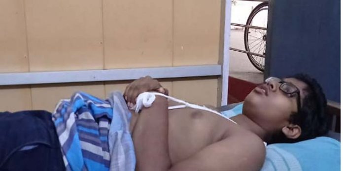 കാട്ടുപന്നിയുടെ ആക്രമണത്തിൽ വിദ്യാർത്ഥിക്ക് ഗുരുതര പരിക്ക് കാട്ടുപന്നിയുടെ ആക്രമണത്തിൽ വിദ്യാർത്ഥിക്ക് ഗുരുതര പരിക്ക്