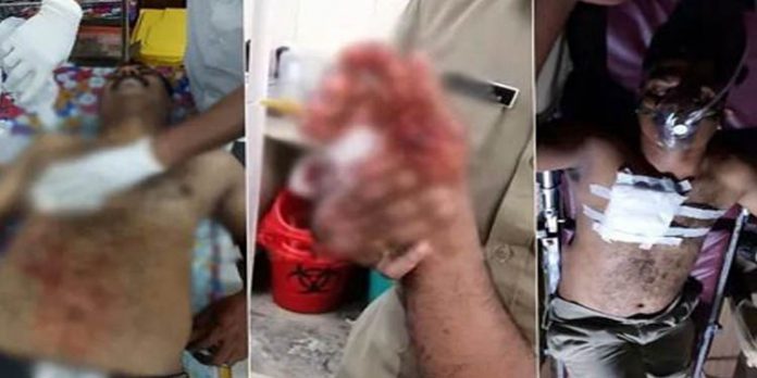 ആലപ്പുഴ ജില്ലയില് രണ്ടിടങ്ങളില് പോലിസുകാര്ക്ക് നേരെ ആക്രമണം ; ഒരാള് പിടിയില് ആലപ്പുഴ ജില്ലയില് രണ്ടിടങ്ങളില് പോലിസുകാര്ക്ക് നേരെ ആക്രമണം ; ഒരാള് പിടിയില്