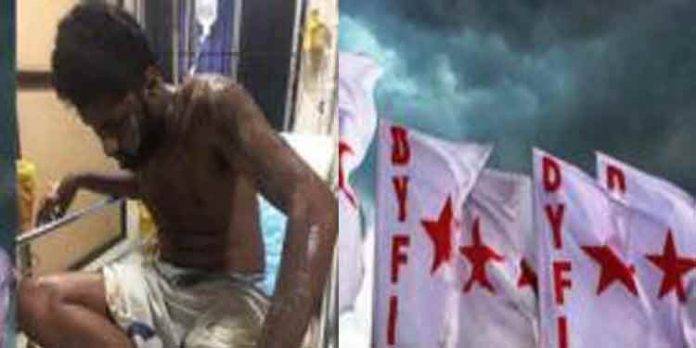 ഡിവൈഎഫ്ഐ കോതമംഗലം ബ്ലോക്ക് പ്രസിഡണ്ട് ജിയോ പയസിന് നേരെ ആസിഡ് ആക്രമണം ഡിവൈഎഫ്ഐ കോതമംഗലം ബ്ലോക്ക് പ്രസിഡണ്ട് ജിയോ പയസിന് നേരെ ആസിഡ് ആക്രമണം