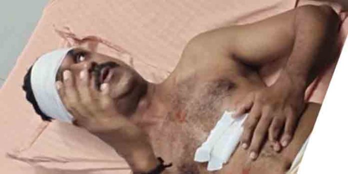 പെരുമ്പാവൂരില് ബിജെപി പ്രവര്ത്തകന് വെട്ടേറ്റു പെരുമ്പാവൂരില് ബിജെപി പ്രവര്ത്തകന് വെട്ടേറ്റു