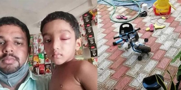 വീടിനടുത്ത് സ്ഥിരമായി കൂട്ടംകൂടി മദ്യപിച്ച് ശല്യം ചെയ്യുന്നത് ചോദ്യം ചെയ്ത കുടുംബത്തിന്റെ വീട് ആക്രമിച്ചു ; കുഞ്ഞിനെയടക്കം ക്രൂരമായി ആക്രമിച്ചു വീടിനടുത്ത് സ്ഥിരമായി കൂട്ടംകൂടി മദ്യപിച്ച് ശല്യം ചെയ്യുന്നത് ചോദ്യം ചെയ്ത കുടുംബത്തിന്റെ വീട് ആക്രമിച്ചു ; കുഞ്ഞിനെയടക്കം ക്രൂരമായി ആക്രമിച്ചു