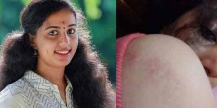 ഭര്തൃ വീട്ടിലെ പീഡനo : യുവതി തൂങ്ങി മരിച്ചു , കൊലപാതകമെന്ന് ബന്ധുക്കള് ; വനിത കമ്മീഷന് സ്വമേധയാ കേസ്സെടുത്തു ഭര്തൃ വീട്ടിലെ പീഡനo : യുവതി തൂങ്ങി മരിച്ചു , കൊലപാതകമെന്ന് ബന്ധുക്കള് ; വനിത കമ്മീഷന് സ്വമേധയാ കേസ്സെടുത്തു
