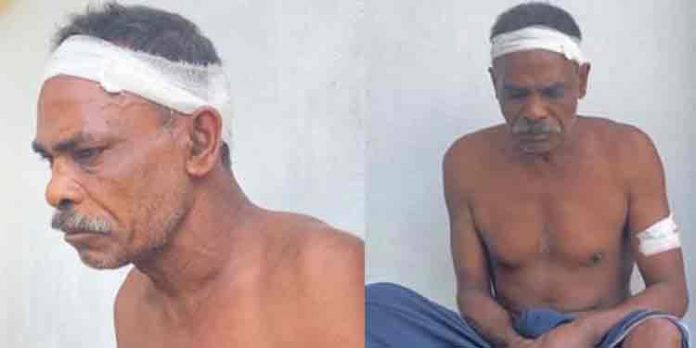 സ്വത്തുതര്ക്കം ; ഉറങ്ങിക്കിടന്ന പിതാവിനെ മകന് വാക്കത്തിക്ക് വെട്ടി കൊല്ലാന് ശ്രമിച്ചു സ്വത്തുതര്ക്കം ; ഉറങ്ങിക്കിടന്ന പിതാവിനെ മകന് വാക്കത്തിക്ക് വെട്ടി കൊല്ലാന് ശ്രമിച്ചു