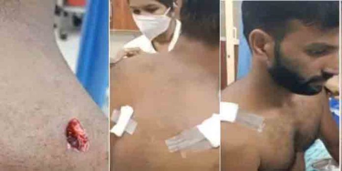 ടാപ്പിംഗ് തൊഴിലാളിക്ക് കടുവയുടെ ആക്രമണത്തില് പരിക്കേറ്റു ടാപ്പിംഗ് തൊഴിലാളിക്ക് കടുവയുടെ ആക്രമണത്തില് പരിക്കേറ്റു