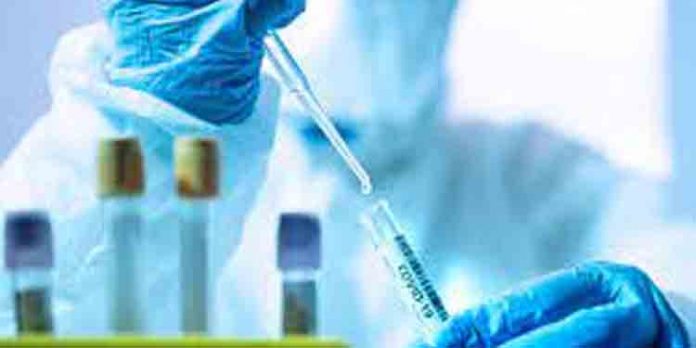 ലോകത്ത് കൊവിഡ് ബാധിതരുടെ എണ്ണം 19.22 കോടിയായി ലോകത്ത് കൊവിഡ് ബാധിതരുടെ എണ്ണം 19.22 കോടിയായി