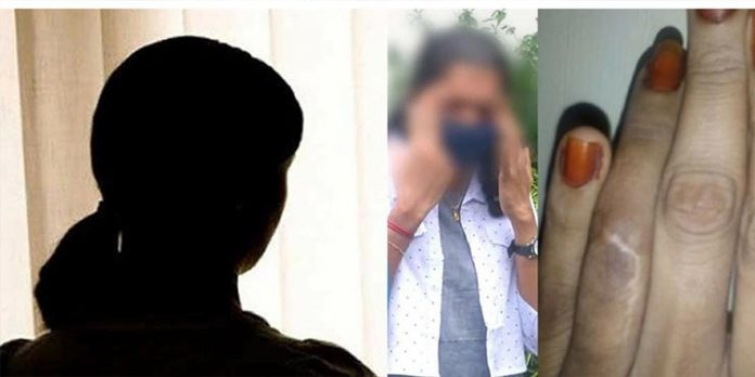 തിളച്ച പാല് ചെവിയിലൊഴിച്ചു – വിരൽ ഒടിച്ചു ; ഭർത്താവിനെ പേടിച്ച് ആലപ്പുഴക്കാരി അയൽനാട്ടിൽ തിളച്ച പാല് ചെവിയിലൊഴിച്ചു – വിരൽ ഒടിച്ചു ; ഭർത്താവിനെ പേടിച്ച് ആലപ്പുഴക്കാരി അയൽനാട്ടിൽ