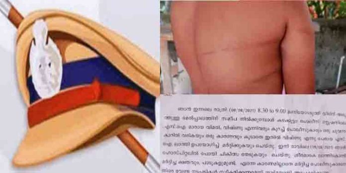 തല്ലിയത് വിഷ്ണു, പണികിട്ടിയത് വിമലിന് ; കഴക്കൂട്ടത്ത് യുവാവിനെ മര്ദ്ദിച്ച കേസില് ആളുമാറി സസ്പെന്ഷന് വിവാദത്തില് തല്ലിയത് വിഷ്ണു, പണികിട്ടിയത് വിമലിന് ; കഴക്കൂട്ടത്ത് യുവാവിനെ മര്ദ്ദിച്ച കേസില് ആളുമാറി സസ്പെന്ഷന് വിവാദത്തില്