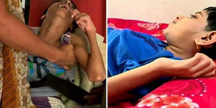 തീരാദുരിതം ; എന്ഡോസള്ഫാന് ഇരകള്ക്ക് അഞ്ചുമാസമായി പെന്ഷനില്ല – ചിങ്ങം ഒന്നിന് ഉപവാസം തീരാദുരിതം ; എന്ഡോസള്ഫാന് ഇരകള്ക്ക് അഞ്ചുമാസമായി പെന്ഷനില്ല – ചിങ്ങം ഒന്നിന് ഉപവാസം