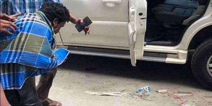 പ്ലംബിംഗ് ജോലിക്കിടെ വൈദ്യുതാഘാതമേറ്റ യുവാവിന് ഗുരുതരമായ പൊള്ളല് പ്ലംബിംഗ് ജോലിക്കിടെ വൈദ്യുതാഘാതമേറ്റ യുവാവിന് ഗുരുതരമായ പൊള്ളല്