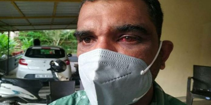 ഇതര തൊഴിലാളിയെ മർദ്ദിക്കുന്നത് ചോദ്യം ചെയ്ത വിമുക്ത ഭടനെ സി.പി.എം പ്രവർത്തകർ മർദ്ദിച്ചെന്ന് പരാതി ഇതര തൊഴിലാളിയെ മർദ്ദിക്കുന്നത് ചോദ്യം ചെയ്ത വിമുക്ത ഭടനെ സി.പി.എം പ്രവർത്തകർ മർദ്ദിച്ചെന്ന് പരാതി