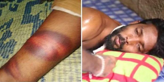 ബൈക്ക് നിര്ത്തി മൂത്രം ഒഴിക്കാൻ ഇറങ്ങിയ രോഗിയായ യുവാവിന് പോലീസ് ക്രൂരമായി മര്ദ്ദിച്ചതായി ആരോപണം ബൈക്ക് നിര്ത്തി മൂത്രം ഒഴിക്കാൻ ഇറങ്ങിയ രോഗിയായ യുവാവിന് പോലീസ് ക്രൂരമായി മര്ദ്ദിച്ചതായി ആരോപണം