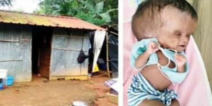 റേഷന്കാര്ഡില് എ.പി.എല് ; ചികിത്സയ്ക്കുപോലും മാര്ഗമില്ലാതെ ഉഷ ചോതിയും കുടുംബവും റേഷന്കാര്ഡില് എ.പി.എല് ; ചികിത്സയ്ക്കുപോലും മാര്ഗമില്ലാതെ ഉഷ ചോതിയും കുടുംബവും