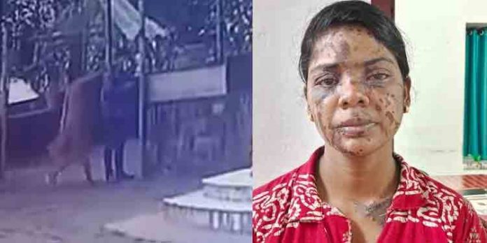 ഫേസ്ബുക്ക് സുഹൃത്തായ യുവാവിനെ വിളിച്ചു വരുത്തി ആസിഡ് ഒഴിച്ച് പരിക്കേല്പ്പിച്ച യുവതി അറസ്റ്റില് ഫേസ്ബുക്ക് സുഹൃത്തായ യുവാവിനെ വിളിച്ചു വരുത്തി ആസിഡ് ഒഴിച്ച് പരിക്കേല്പ്പിച്ച യുവതി അറസ്റ്റില്