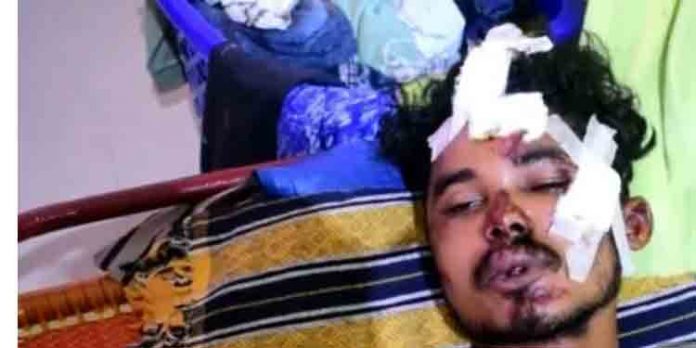 യുവാവിനെ ക്രൂരമായി മര്ദിച്ച പ്രതിക്ക് സ്റ്റേഷന് ജാമ്യം ; എസ്.ഐയുടെ ഭാഗത്ത് നിന്നും ഗുരുതര വീഴ്ച യുവാവിനെ ക്രൂരമായി മര്ദിച്ച പ്രതിക്ക് സ്റ്റേഷന് ജാമ്യം ; എസ്.ഐയുടെ ഭാഗത്ത് നിന്നും ഗുരുതര വീഴ്ച