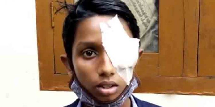പത്താം ക്ലാസ് വിദ്യാർത്ഥിക്ക് അയൽവാസിയുടെ ക്രൂര മർദ്ദനം പത്താം ക്ലാസ് വിദ്യാർത്ഥിക്ക് അയൽവാസിയുടെ ക്രൂര മർദ്ദനം