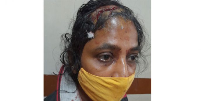പറമ്പിലൂടെ വഴി വെട്ടുന്നത് തടഞ്ഞു ; യുവതിക്കു നേരെ സംഘം ചേർന്ന് ആക്രമണം പറമ്പിലൂടെ വഴി വെട്ടുന്നത് തടഞ്ഞു ; യുവതിക്കു നേരെ സംഘം ചേർന്ന് ആക്രമണം
