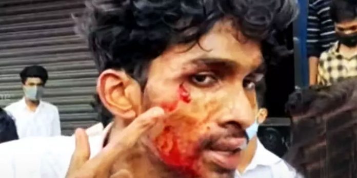 റാഗിങ്ങിന്റെ പേരിൽ ഐ.എച്ച്.ആർ.ഡി കോളേജിൽ വിദ്യാർഥി സംഘർഷം റാഗിങ്ങിന്റെ പേരിൽ ഐ.എച്ച്.ആർ.ഡി കോളേജിൽ വിദ്യാർഥി സംഘർഷം