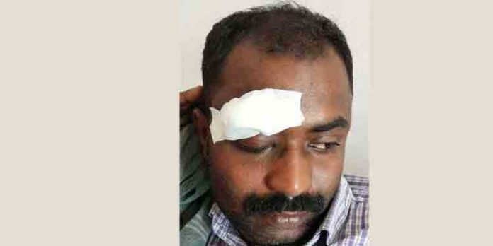 അരുവിക്കുഴി വിനോദസഞ്ചാരകേന്ദ്രത്തില് അഞ്ചംഗ സംഘത്തിന്റെ ആക്രമണത്തില് വാച്ചര്ക്ക് പരിക്ക് അരുവിക്കുഴി വിനോദസഞ്ചാരകേന്ദ്രത്തില് അഞ്ചംഗ സംഘത്തിന്റെ ആക്രമണത്തില് വാച്ചര്ക്ക് പരിക്ക്