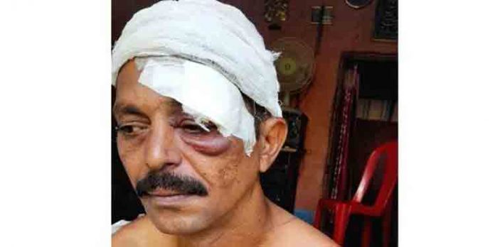 അയല്വാസികള് തമ്മിലുള്ള തര്ക്കo ; ഒരാള്ക്ക് വെട്ടേറ്റു അയല്വാസികള് തമ്മിലുള്ള തര്ക്കo ; ഒരാള്ക്ക് വെട്ടേറ്റു