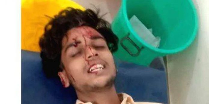 ബസിൽ കയറുന്നതിനെച്ചൊല്ലി സംഘർഷം : ബിയർ കുപ്പി കൊണ്ട് വിദ്യാർത്ഥിയുടെ തലയടിച്ച് തകർത്തു ബസിൽ കയറുന്നതിനെച്ചൊല്ലി സംഘർഷം : ബിയർ കുപ്പി കൊണ്ട് വിദ്യാർത്ഥിയുടെ തലയടിച്ച് തകർത്തു