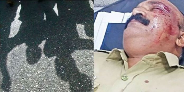 അമ്പലപ്പുഴയില് പോലീസും നാട്ടുകാരും തമ്മില് ഏറ്റുമുട്ടി അമ്പലപ്പുഴയില് പോലീസും നാട്ടുകാരും തമ്മില് ഏറ്റുമുട്ടി