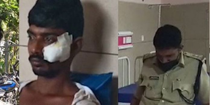 കൊല്ലത്ത് പ്രതിക്ക് പോലീസ് തോക്കില് നിന്ന് അബദ്ധത്തില് വെടിയേറ്റു കൊല്ലത്ത് പ്രതിക്ക് പോലീസ് തോക്കില് നിന്ന് അബദ്ധത്തില് വെടിയേറ്റു