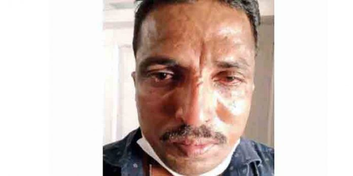 യുവതിയോട് ലൈംഗികാതിക്രമം നടത്തിയ മദ്ധ്യ വയസ്ക്കൻ അറസ്റ്റില് യുവതിയോട് ലൈംഗികാതിക്രമം നടത്തിയ മദ്ധ്യ വയസ്ക്കൻ അറസ്റ്റില്
