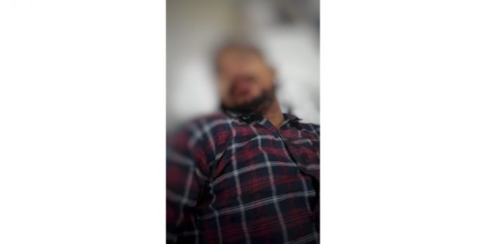 ബൈക്ക് അപകടം ; യുവാവിന് പരിക്കേറ്റു ബൈക്ക് അപകടം ; യുവാവിന് പരിക്കേറ്റു