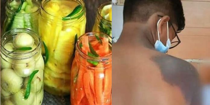 വിദ്യാർത്ഥി അവശനിലയിലായ സംഭവം ; തട്ടുകടകളിലെ ലായനിയിൽ ആസിഡ് ഇല്ലെന്ന് പരിശോധന ഫലം വിദ്യാർത്ഥി അവശനിലയിലായ സംഭവം ; തട്ടുകടകളിലെ ലായനിയിൽ ആസിഡ് ഇല്ലെന്ന് പരിശോധന ഫലം
