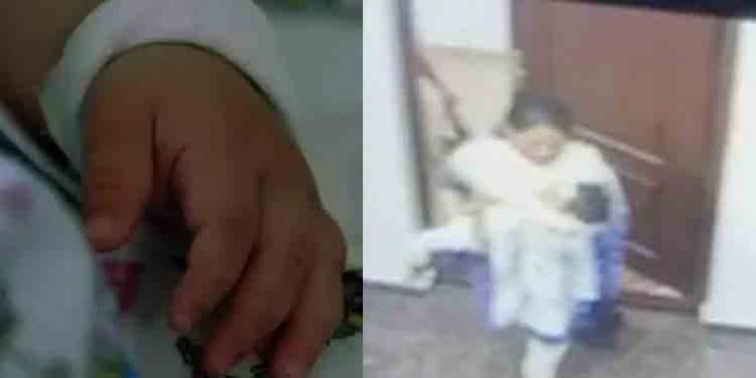 തൃക്കാക്കരയില് പരിക്കേറ്റ രണ്ടര വയസ്സുകാരിയെ ഡിസ്ചാര്ജ് ചെയ്യും തൃക്കാക്കരയില് പരിക്കേറ്റ രണ്ടര വയസ്സുകാരിയെ ഡിസ്ചാര്ജ് ചെയ്യും
