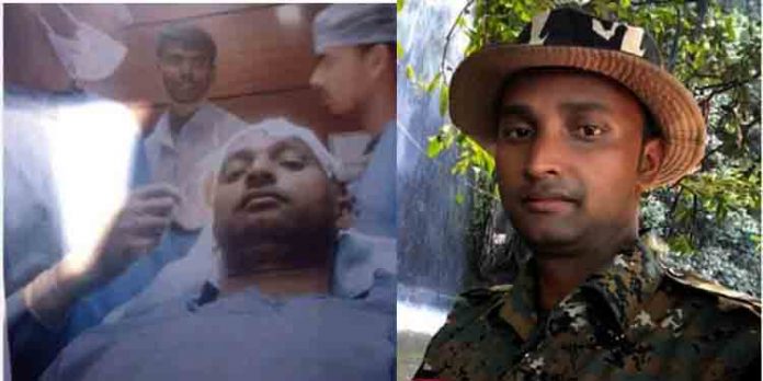 വിവാഹം പ്രമാണിച്ച് ഹെയർ ട്രാൻസ്പ്ലാന്റ് ചെയ്ത പോലീസുദ്യോഗസ്ഥന് ദാരുണാന്ത്യം വിവാഹം പ്രമാണിച്ച് ഹെയർ ട്രാൻസ്പ്ലാന്റ് ചെയ്ത പോലീസുദ്യോഗസ്ഥന് ദാരുണാന്ത്യം