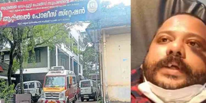 തിരുവനന്തപുരത്ത് വീണ്ടും പോലീസ് മൂന്നാംമുറ? ആറ്റിങ്ങല് എസ്ഐക്കെതിരെ പരാതി ; അന്വേഷണം തുടങ്ങി തിരുവനന്തപുരത്ത് വീണ്ടും പോലീസ് മൂന്നാംമുറ? ആറ്റിങ്ങല് എസ്ഐക്കെതിരെ പരാതി ; അന്വേഷണം തുടങ്ങി