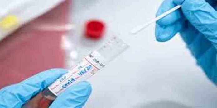 ഇടുക്കി ജില്ലയില് 48 പേര്ക്ക് കൂടി കോവിഡ് സ്ഥിരീകരിച്ചു ഇടുക്കി ജില്ലയില് 48 പേര്ക്ക് കൂടി കോവിഡ് സ്ഥിരീകരിച്ചു
