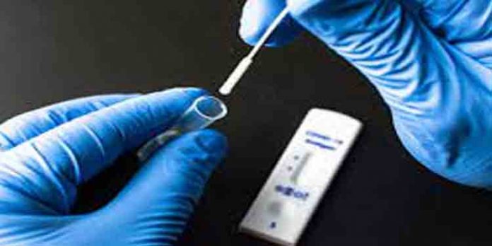 എറണാകുളം ജില്ലയില് ഇന്ന് 76 പേര്ക്ക് കൊവിഡ് സ്ഥിരീകരിച്ചു എറണാകുളം ജില്ലയില് ഇന്ന് 76 പേര്ക്ക് കൊവിഡ് സ്ഥിരീകരിച്ചു