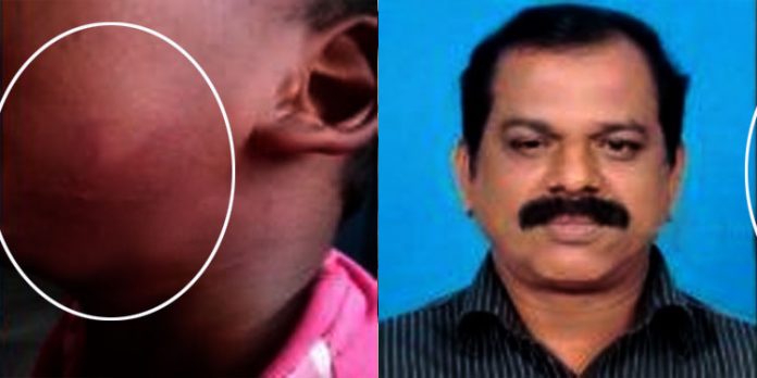 കുഞ്ഞുങ്ങളെ ക്രൂരമായി മര്ദിച്ച ശിശുക്ഷേമ സമിതി സെക്രട്ടറിക്കെതിരെ അന്വേഷണം കുഞ്ഞുങ്ങളെ ക്രൂരമായി മര്ദിച്ച ശിശുക്ഷേമ സമിതി സെക്രട്ടറിക്കെതിരെ അന്വേഷണം