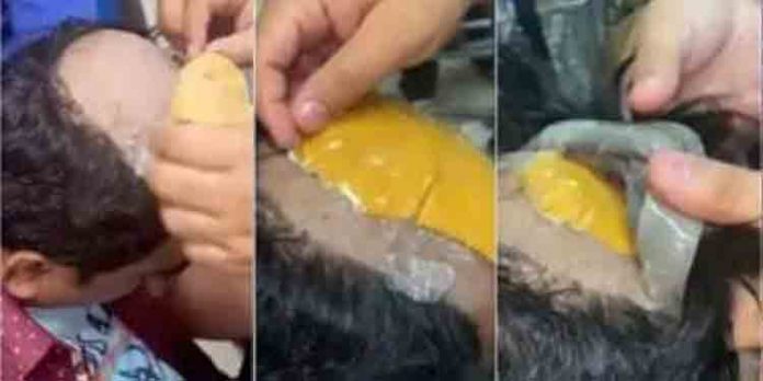 തലയിലെ വിഗ്ഗിനടിയില് സ്വര്ണം ഒളിപ്പിച്ച് കടത്താന് ശ്രമിച്ചയാള് പിടിയില് തലയിലെ വിഗ്ഗിനടിയില് സ്വര്ണം ഒളിപ്പിച്ച് കടത്താന് ശ്രമിച്ചയാള് പിടിയില്