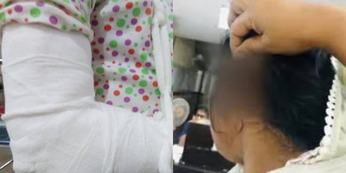 താമരശേരിയിൽ 9 വയസുകാരിയോട് ക്രൂരത ; ദേഹത്ത് തിളച്ച വെള്ളമൊഴിച്ച് പൊള്ളിച്ചു താമരശേരിയിൽ 9 വയസുകാരിയോട് ക്രൂരത ; ദേഹത്ത് തിളച്ച വെള്ളമൊഴിച്ച് പൊള്ളിച്ചു