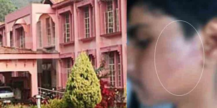 ഭക്ഷണ സാധനങ്ങള് മോഷ്ടിച്ചെന്ന് ആരോപിച്ച് ജൂനിയര് വിദ്യാര്ഥികളെ സീനിയര് വിദ്യാര്ഥികള് മര്ദ്ദിച്ചതായി പരാതി ഭക്ഷണ സാധനങ്ങള് മോഷ്ടിച്ചെന്ന് ആരോപിച്ച് ജൂനിയര് വിദ്യാര്ഥികളെ സീനിയര് വിദ്യാര്ഥികള് മര്ദ്ദിച്ചതായി പരാതി