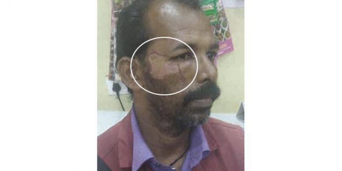 സ്കൂട്ടറില് പന്നി ഇടിച്ച് ലോട്ടറി വില്പനക്കാരന് പരുക്കേറ്റു സ്കൂട്ടറില് പന്നി ഇടിച്ച് ലോട്ടറി വില്പനക്കാരന് പരുക്കേറ്റു