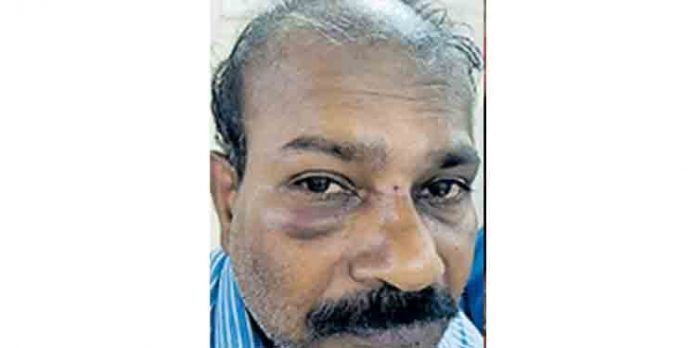 അമിതമായി യാത്രക്കാരെ കയറ്റിയെന്നാരോപിച്ച് കെഎസ്ആര്ടിസി ബസ് കണ്ടക്ടറെ മര്ദിച്ച് യാത്രക്കാരന് അമിതമായി യാത്രക്കാരെ കയറ്റിയെന്നാരോപിച്ച് കെഎസ്ആര്ടിസി ബസ് കണ്ടക്ടറെ മര്ദിച്ച് യാത്രക്കാരന്