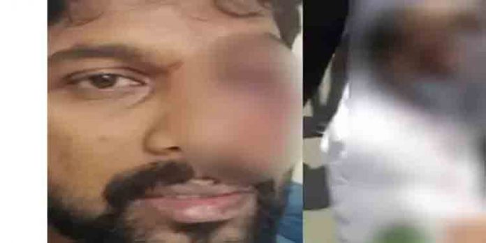 പോലീസ് മര്ദ്ദനം ; യൂത്ത് കോണ്ഗ്രസ് നേതാവിന്റെ കാഴ്ച നഷ്ടപ്പെട്ടു പോലീസ് മര്ദ്ദനം ; യൂത്ത് കോണ്ഗ്രസ് നേതാവിന്റെ കാഴ്ച നഷ്ടപ്പെട്ടു