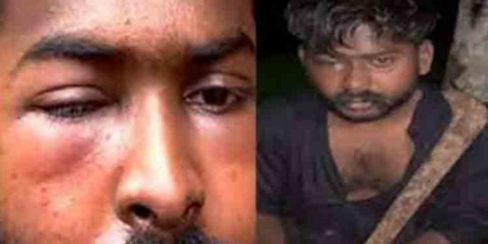 ബാലുശേരിയിലെ ആള്ക്കൂട്ട ആക്രമണത്തില് രണ്ടുപേര് കസ്റ്റഡിയില് ബാലുശേരിയിലെ ആള്ക്കൂട്ട ആക്രമണത്തില് രണ്ടുപേര് കസ്റ്റഡിയില്