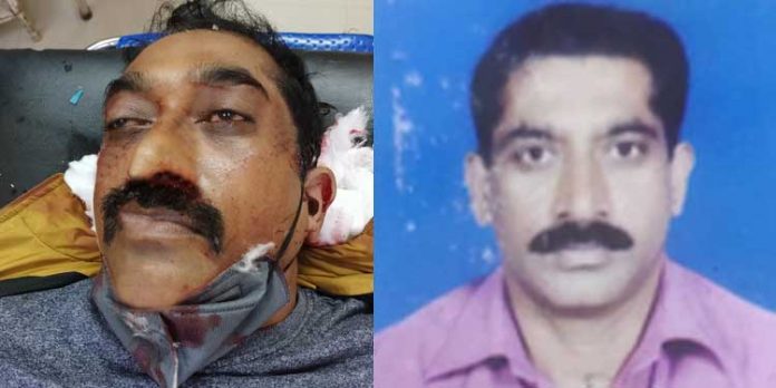 ഇന്ന് രാവിലെ 6 മണിക്ക് ഹരിപ്പാട് വെച്ചുണ്ടായ വാഹനാപകടത്തില് മരിച്ച ഇദ്ദേഹത്തെ ഇതുവരെ തിരിച്ചറിഞ്ഞിട്ടില്ല ഇന്ന് രാവിലെ 6 മണിക്ക് ഹരിപ്പാട് വെച്ചുണ്ടായ വാഹനാപകടത്തില് മരിച്ച ഇദ്ദേഹത്തെ ഇതുവരെ തിരിച്ചറിഞ്ഞിട്ടില്ല