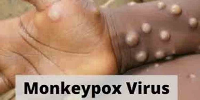 രാജ്യത്ത് മങ്കി പോക്സ് ബാധിതരുടെ എണ്ണം കൂടാന് സാധ്യത : കേന്ദ്ര ആരോഗ്യവകുപ്പ് രാജ്യത്ത് മങ്കി പോക്സ് ബാധിതരുടെ എണ്ണം കൂടാന് സാധ്യത : കേന്ദ്ര ആരോഗ്യവകുപ്പ്