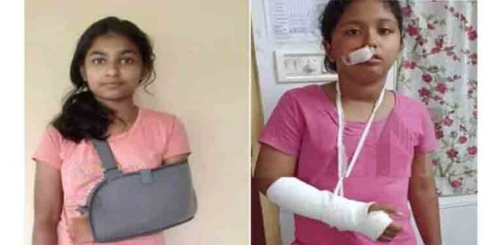 പൊതുമരാമത്ത് റോഡിലെ കുഴിയില് വീണ് സൈക്കിള് യാത്രികരായ രണ്ട് പെണ്കുട്ടികള്ക്ക് പരുക്ക് പൊതുമരാമത്ത് റോഡിലെ കുഴിയില് വീണ് സൈക്കിള് യാത്രികരായ രണ്ട് പെണ്കുട്ടികള്ക്ക് പരുക്ക്